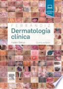 Libro Ferrándiz. Dermatología clínica