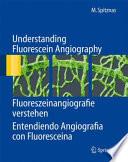 Libro Understanding Fluorescein Angiography, Fluoreszeinangiografie verstehen, Entendiendo Angiografía con Fluoresceína